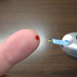 picture of a finger prick tests for diabetes