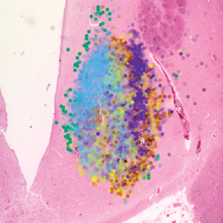 Hypomap image