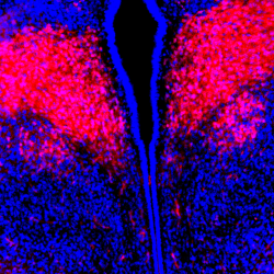 image of the brain