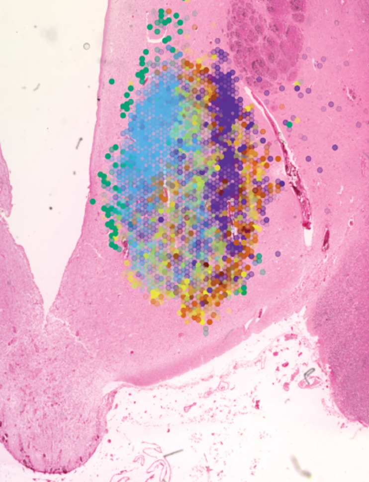 Hypomap image