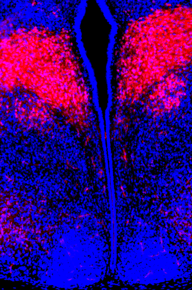 image of the brain